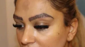 Natural Eyebrow Transplant for a Transformed Expression: The Ultimate Way to Move Beyond Permanent Makeup