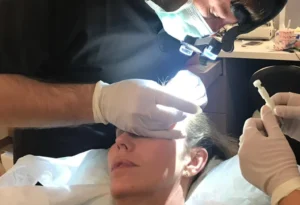 Hair Transplant for Women: Restore Your Confidence Naturally